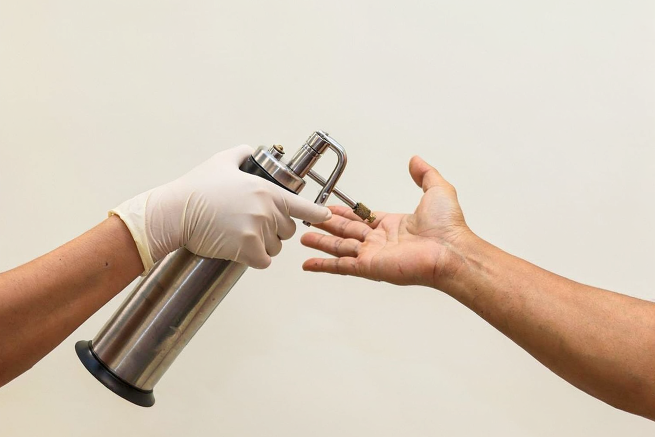 Laser vs. odstranění bradavic dusíkem. Která metoda funguje lépe a šetrněji? obrázek 20 Laser vs. odstranění bradavic dusíkem. Která metoda funguje lépe a šetrněji? obrázek 19